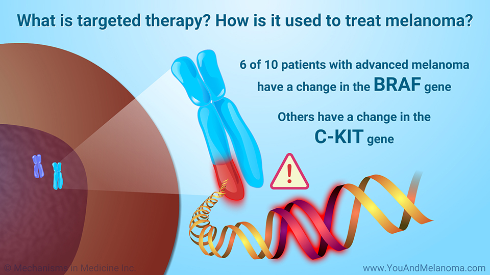 What is targeted therapy? How is it used to treat melanoma?