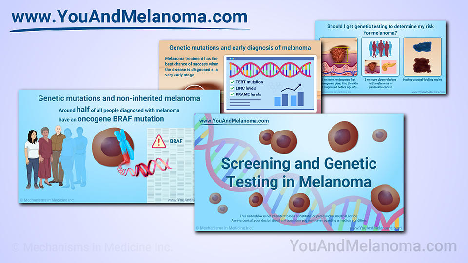 Slide Show - Genetic Mutations and Melanoma