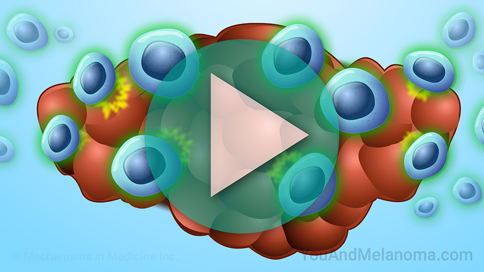 TIL Cell Therapy for Melanoma